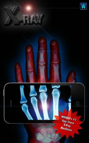 手机扫描骨骼_图2